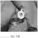 Fig. 52 - ADJUSTABLE CONNECTOR AND DEAD SPACE REDUCTION
