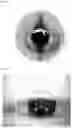 Fig. 04 - 3-dimensional measurement method for eye movement and fully automated deep-learning based system for vertigo diagnosis