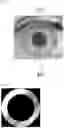 Fig. 05 - 3-dimensional measurement method for eye movement and fully automated deep-learning based system for vertigo diagnosis