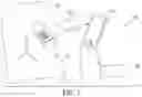 Fig. 02 - Systems and methods for assessing sympathetic nervous system tone for renal neuromodulation therapy