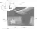 Fig. 01 - System and method for screening a patient's foot