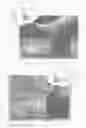 Fig. 02 - System and method for screening a patient's foot