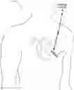 Fig. 01 - Identification of false asystole detection