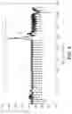 Fig. 10 - Identification of false asystole detection