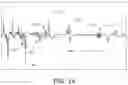 Fig. 15 - Identification of false asystole detection