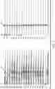 Fig. 10 - System for diagnosing mental disorders using neurometrics