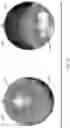 Fig. 11 - System for diagnosing mental disorders using neurometrics