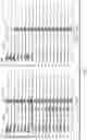 Fig. 12 - System for diagnosing mental disorders using neurometrics