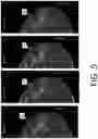 Fig. 06 - System and method for navigating a tomosynthesis stack including automatic focusing