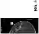 Fig. 07 - System and method for navigating a tomosynthesis stack including automatic focusing