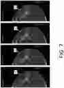 Fig. 08 - System and method for navigating a tomosynthesis stack including automatic focusing