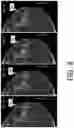 Fig. 09 - System and method for navigating a tomosynthesis stack including automatic focusing