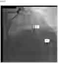 Fig. 07 - AUTOMATIC DISPLAY OF PREVIOUSLY-ACQUIRED ENDOLUMINAL IMAGES