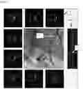 Fig. 09 - AUTOMATIC DISPLAY OF PREVIOUSLY-ACQUIRED ENDOLUMINAL IMAGES