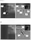 Fig. 10 - AUTOMATIC DISPLAY OF PREVIOUSLY-ACQUIRED ENDOLUMINAL IMAGES