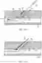 Fig. 16 - Apparatus and methods for accessing and closing multiple penetrations on a blood vessel