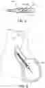 Fig. 03 - Introducer sheath assembly for catheter systems and methods of using same