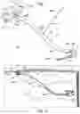 Fig. 02 - Cantilever liver retraction devices and methods of use