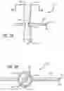 Fig. 04 - Knotless Suture Anchor for Soft Tissue Repair and Method of Use