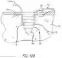 Fig. 12 - Knotless Suture Anchor for Soft Tissue Repair and Method of Use