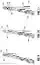 Fig. 06 - Surgical end effectors