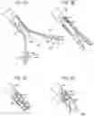 Fig. 03 - Suture passing device