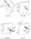 Fig. 05 - Suture passing device