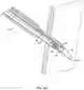 Fig. 06 - Suture passing device