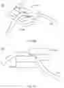 Fig. 30 - Suture passing device