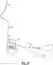 Fig. 08 - Surgical device with trigger operated needle