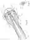 Fig. 05 - Surgical stapler with rotary cam drive