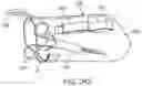 Fig. 104 - Systems and methods for increased operating room efficiency