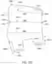Fig. 148 - Systems and methods for increased operating room efficiency