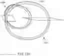 Fig. 150 - Systems and methods for increased operating room efficiency