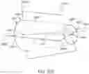 Fig. 151 - Systems and methods for increased operating room efficiency