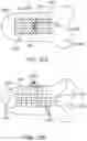 Fig. 154 - Systems and methods for increased operating room efficiency