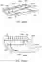 Fig. 158 - Systems and methods for increased operating room efficiency
