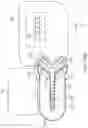 Fig. 66 - Systems and methods for increased operating room efficiency
