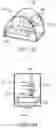 Fig. 80 - Systems and methods for increased operating room efficiency