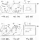 Fig. 93 - Systems and methods for increased operating room efficiency