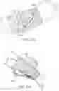 Fig. 96 - Systems and methods for increased operating room efficiency