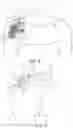 Fig. 04 - Fastener delivery system and related methods