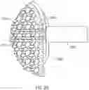 Fig. 18 - Fastener delivery system and related methods