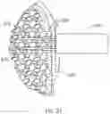 Fig. 19 - Fastener delivery system and related methods