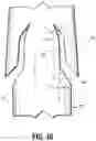 Fig. 06 - Compound barb medical device and method