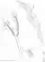 Fig. 14 - END EFFECTOR FOR USE WITH A SURGICAL FASTENING INSTRUMENT