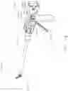 Fig. 19 - Articulation pin for a surgical instrument