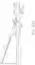 Fig. 52 - Powered surgical instruments with firing system lockout arrangements