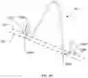 Fig. 05 - Tissue alignment for surgical closure