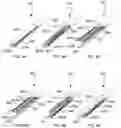 Fig. 24 - Tissue alignment for surgical closure